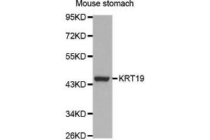 Western Blotting (WB) image for anti-Keratin 19 (KRT19) (AA 241-400) antibody (ABIN3020779) (Cytokeratin 19 anticorps  (AA 241-400))
