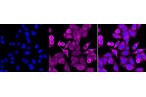 anti-Protein Kinase C, beta (PRKCB) antibody