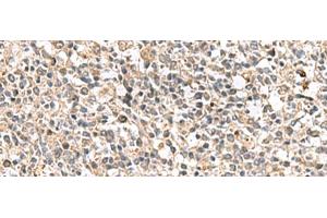 Immunohistochemistry of paraffin-embedded Human tonsil tissue using PTPRS Polyclonal Antibody at dilution of 1:110(x200) (PTPRS anticorps)