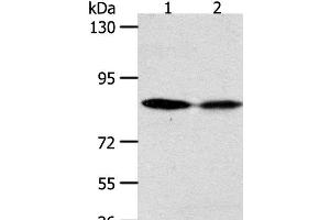 Western Blot analysis of Hela and SKOV3 cell using ADAM11 Polyclonal Antibody at dilution of 1:500 (ADAM11 anticorps)