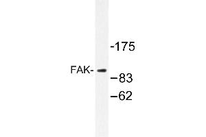 Image no. 1 for anti-PTK2 Protein tyrosine Kinase 2 (PTK2) antibody (ABIN272099) (FAK anticorps)