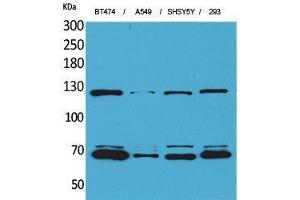 Western Blotting (WB) image for anti-K-Cadherin (CDH6) (Internal Region) antibody (ABIN3187664) (CDH6 anticorps  (Internal Region))