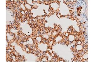 ABIN6267524 at 1/200 staining Mouse lung tissue sections by IHC-P.
