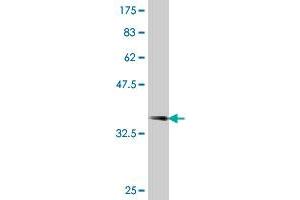 Western Blot detection against Immunogen (38. (PRPS2 anticorps  (AA 160-269))