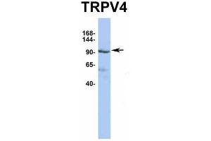 Host:  Rabbit  Target Name:  TRPV4  Sample Type:  PANC1  Antibody Dilution:  1.
