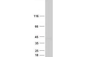 Validation with Western Blot
