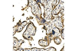 Immunohistochemistry of paraffin-embedded human placenta using PDGFB Rabbit pAb (ABIN3021688, ABIN3021689, ABIN3021690 and ABIN6215511) at dilution of 1:150 (40x lens).