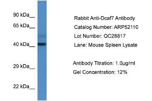 Western Blotting (WB) image for anti-DDB1 and CUL4 Associated Factor 7 (DCAF7) (N-Term) antibody (ABIN2784780)