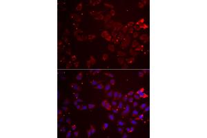 Immunofluorescence analysis of A549 cells using GATM antibody. (GATM anticorps)