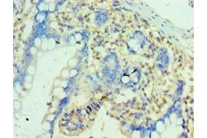 Immunohistochemistry of paraffin-embedded human small intestine tissue using ABIN7162868 at dilution of 1:100