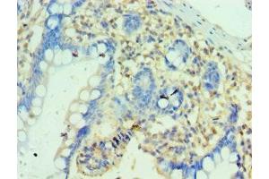 Immunohistochemistry of paraffin-embedded human small intestine tissue using ABIN7162868 at dilution of 1:100 (PTRH2 anticorps  (AA 40-179))
