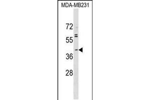 Western blot analysis in MDA-MB231 cell line lysates (35ug/lane). (ABO anticorps  (N-Term))