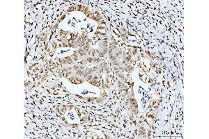 IHC analysis of 53BP1/TP53BP1 using anti-53BP1/TP53BP1 antibody (ABIN7599869). (TP53BP1 anticorps  (AA 1239-1972))