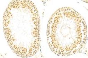 Immunohistochemistry analysis of paraffin-embedded rat testis using,SIN1 (ABIN7074669) at dilution of 1: 500 (MAPKAP1 anticorps)