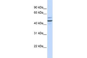 WB Suggested Anti-GOLM1 Antibody Titration: 0. (GOLM1 anticorps  (N-Term))