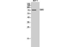 Western Blotting (WB) image for anti-Egf-Like Module Containing, Mucin-Like, Hormone Receptor-Like 2 (EMR2) (Internal Region) antibody (ABIN3188026) (EMR2 anticorps  (Internal Region))