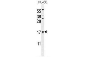 CNIH2 Antibody (N-term) western blot analysis in HL-60 cell line lysates (35µg/lane). (CNIH2 anticorps  (N-Term))
