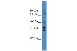 WB Suggested Anti-GIPC3 Antibody Titration:  0. (GIPC3 anticorps  (Middle Region))