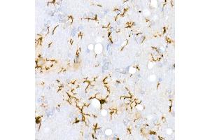 Immunohistochemistry of paraffin-embedded Rat brain using /IB antibody (ABIN7265554) at dilution of 1:100 (40x lens). (Iba1 anticorps)