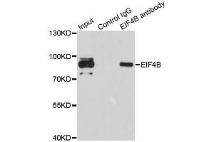 Immunoprecipitation analysis of 200 μg extracts of 293T cells using 1 μg EIF4B antibody (ABIN5973134). (EIF4B anticorps)