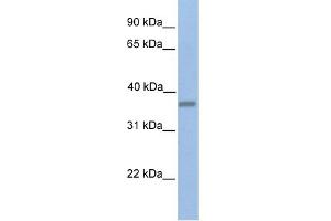 WB Suggested Anti-EMID1 Antibody Titration:  0. (EMID1 anticorps  (C-Term))
