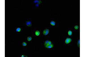 Immunofluorescent analysis of MCF-7 cells using ABIN7154138 at dilution of 1:100 and Alexa Fluor 488-congugated AffiniPure Goat Anti-Rabbit IgG(H+L) (GAPDH anticorps  (AA 3-335))