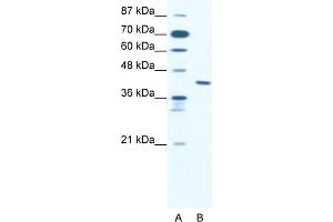 WB Suggested Anti-ZNF621 Antibody Titration:  2. (ZNF621 anticorps  (Middle Region))