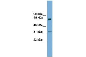 WB Suggested Anti-Pias2 Antibody Titration:  0. (PIAS2 anticorps  (N-Term))