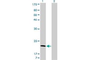 Western Blot analysis of ARF5 expression in transfected 293T cell line by ARF5 monoclonal antibody (M01), clone 1B4. (ARF5 anticorps  (AA 81-180))