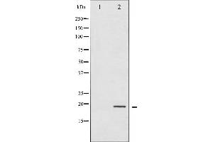 Western blot analysis of 4E-BP1 phosphorylation expression in EGF treated MDA-MB-435 whole cell lysates,The lane on the left is treated with the antigen-specific peptide.