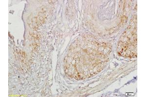 Formalin-fixed and paraffin embedded mouse stomach labeled with Anti-Gastrin receptor Polyclonal Antibody, Unconjugated (ABIN734318) at 1:200 followed by conjugation to the secondary antibody and DAB staining