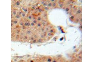 Used in DAB staining on fromalin fixed paraffin-embedded Liver tissue