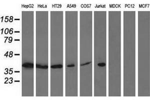 Western blot analysis of extracts (35 µg) from 9 different cell lines by using anti-ACAT2 monoclonal antibody. (ACAT2 anticorps)