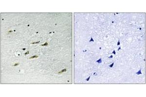 Immunohistochemistry analysis of paraffin-embedded human brain tissue, using JAK2 (Ab-931) Antibody. (JAK2 anticorps  (AA 906-955))