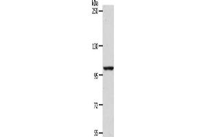 Gel: 8 % SDS-PAGE, Lysate: 40 μg, Lane: NIH/3T3 cells, Primary antibody: ABIN7189656(ADAMTS17 Antibody) at dilution 1/1200, Secondary antibody: Goat anti rabbit IgG at 1/8000 dilution, Exposure time: 1 hour