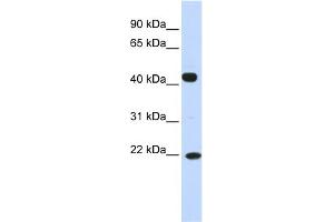 WB Suggested Anti-SSX4 Antibody Titration:  0. (SSX4 anticorps  (N-Term))