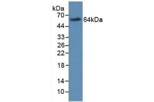 Detection of Recombinant MBP, Human using Monoclonal Antibody to Major Basic Protein (MBP) (Major Basic Protein anticorps  (AA 105-222))