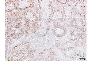 Formalin-fixed and paraffin embedded: rat kidney tissue labeled with Anti-CRF/CRH Polyclonal Antibody, Unconjugated (ABIN739430) at 1:200, followed by conjugation to the secondary antibody and DAB staining (CRH anticorps  (AA 145-185))