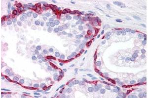 Human Prostate: Formalin-Fixed, Paraffin-Embedded (FFPE)