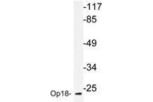 Western blot analyzes of Op18 antibody in extracts from HepG2 cells. (Stathmin 1 anticorps)