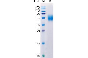 Human MICA Protein, His Tag on SDS-PAGE under reducing condition.