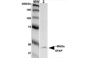 Western Blot analysis of Rat Brain Membrane showing detection of GFAP protein using Mouse Anti-GFAP Monoclonal Antibody, Clone S206A-8 . (GFAP anticorps  (AA 411-422) (Biotin))