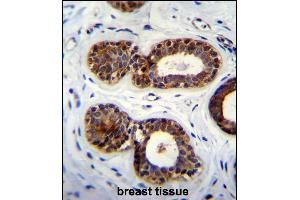 QTRTD1 Antibody (C-term) (ABIN655642 and ABIN2845119) immunohistochemistry analysis in formalin fixed and paraffin embedded human breast tissue followed by peroxidase conjugation of the secondary antibody and DAB staining.