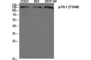 Western Blotting (WB) image for anti-Fms-Related tyrosine Kinase 1 (VEGFR1) (FLT1) (pTyr1048) antibody (ABIN3182936) (FLT1 anticorps  (pTyr1048))