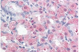 Human Stomach: Formalin-Fixed, Paraffin-Embedded (FFPE)