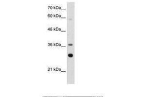 Image no. 1 for anti-Ribosomal Protein, Large, P0 (RPLP0) (AA 182-231) antibody (ABIN203302) (RPLP0 anticorps  (AA 182-231))