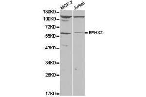 Western Blotting (WB) image for anti-Epoxide Hydrolase 2, Cytoplasmic (EPHX2) antibody (ABIN1872559) (EPHX2 anticorps)