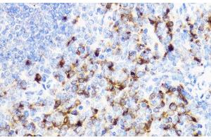 Immunohistochemistry of paraffin-embedded Mouse spleen using YKL-40 / CHI3L1 Polyclonal Antibody at dilution of 1:100 (40x lens). (CHI3L1 anticorps)