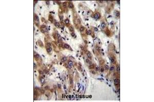 PHF20 Antibody (N-term) (ABIN656095 and ABIN2845438) immunohistochemistry analysis in formalin fixed and paraffin embedded human liver tissue followed by peroxidase conjugation of the secondary antibody and DAB staining.