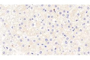 Detection of Hepc in Human Liver Tissue using Polyclonal Antibody to Hepcidin (Hepc) (Hepcidin anticorps  (AA 25-84))
